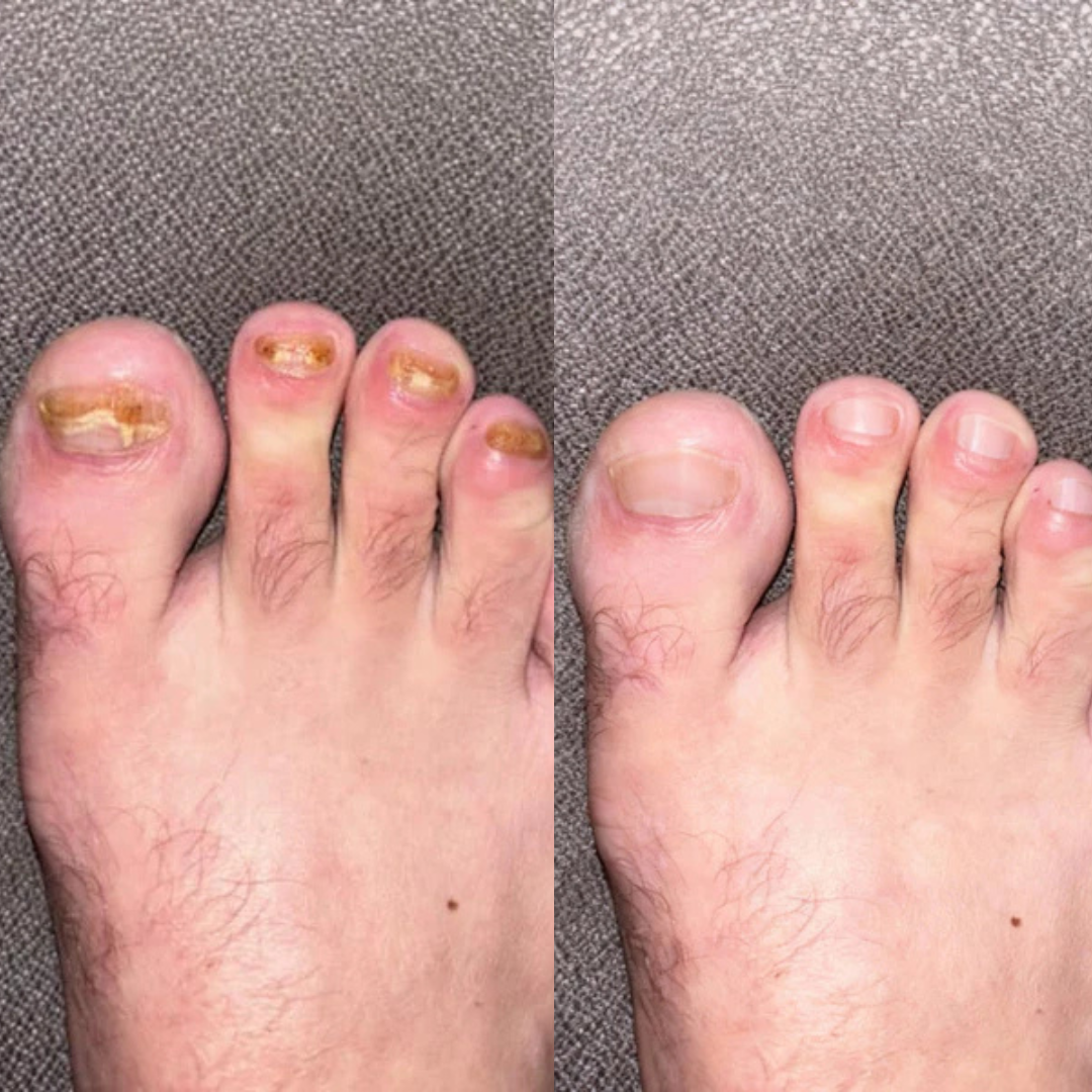 Armando review photo